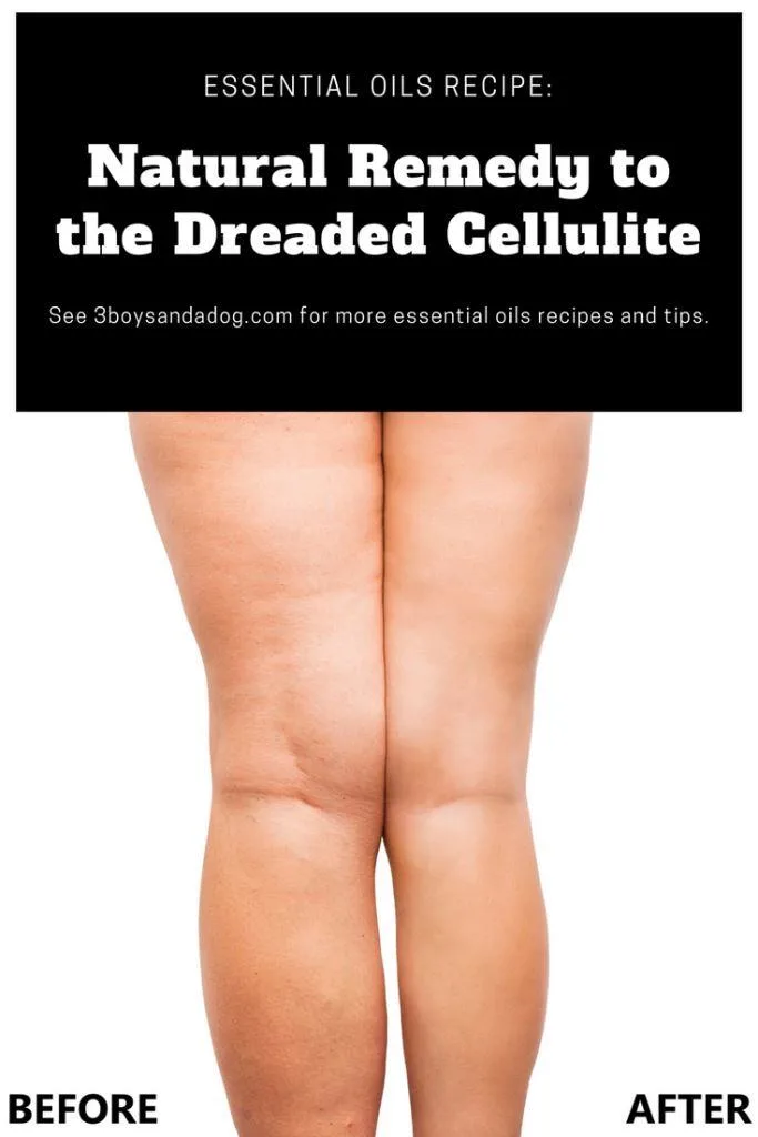 best essential oil for cellulite reduction