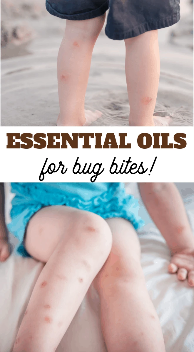 the best essential oils to have on hand in case of bug bites and stings