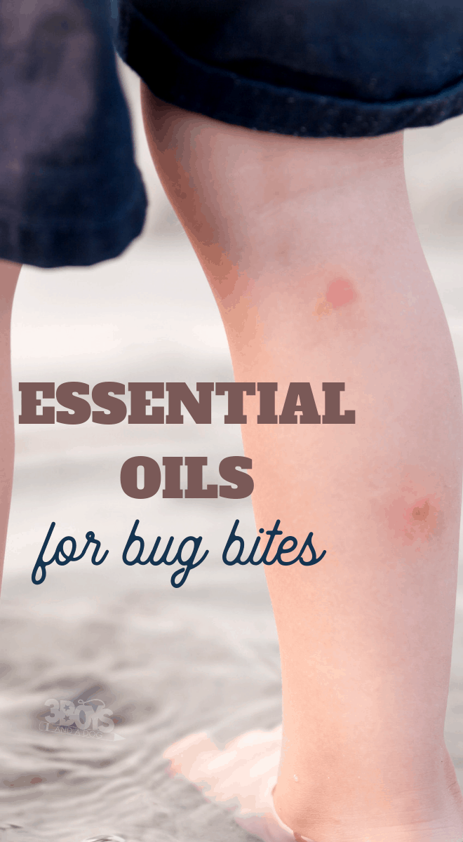 these common essential oils should be in your first aid kit for bug bites