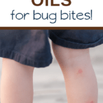 heal bug bites with this list of essential oils