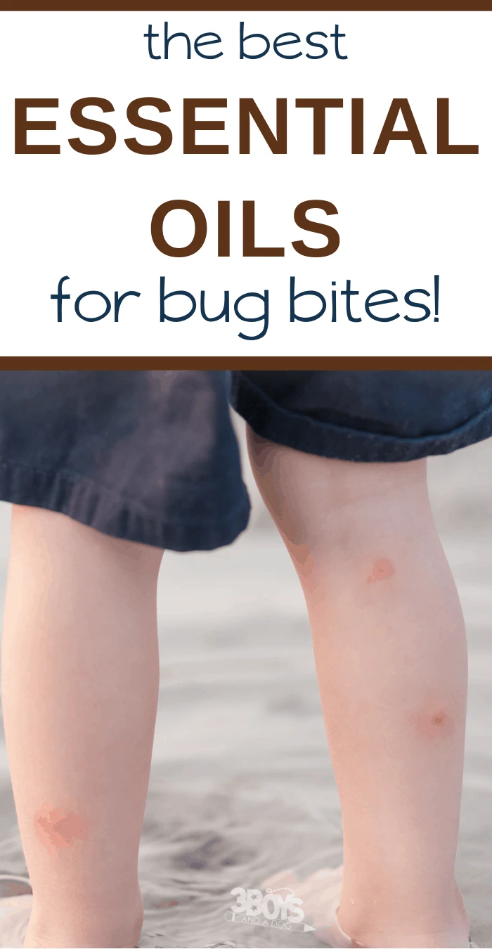 heal bug bites with this list of essential oils