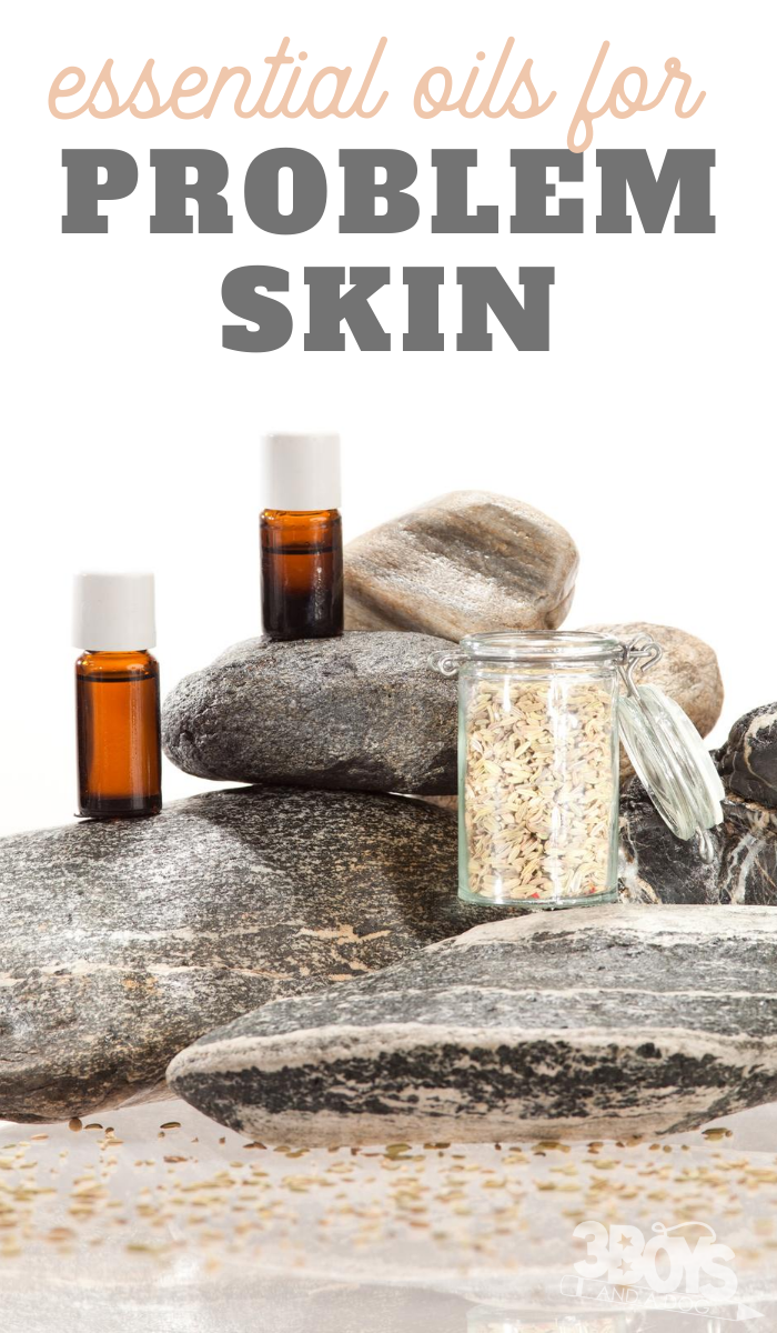 best essential oils for problem skin